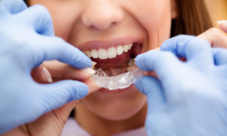 Aparat ortodontyczny